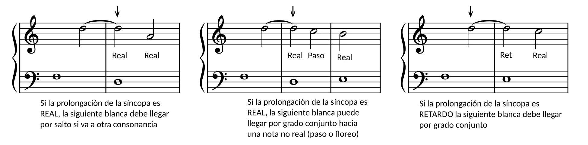 Syncope
