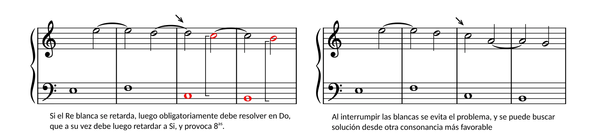 Syncope
